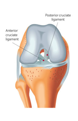 Posterior Cruciate Ligament Knee Surgery Santry