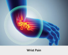 Hand And Wrist Surgery - Causes And Treatments Ssc