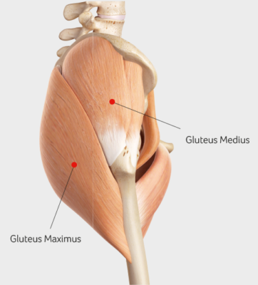 Gluteus Medius Tendinopathy At Sports Surgery Clinic